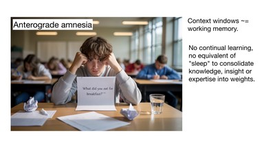 Anterograde amnesia